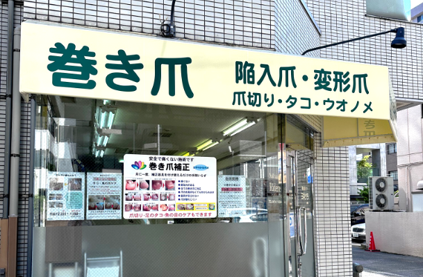 巻き爪ケア ヨネクラ 船橋店画像