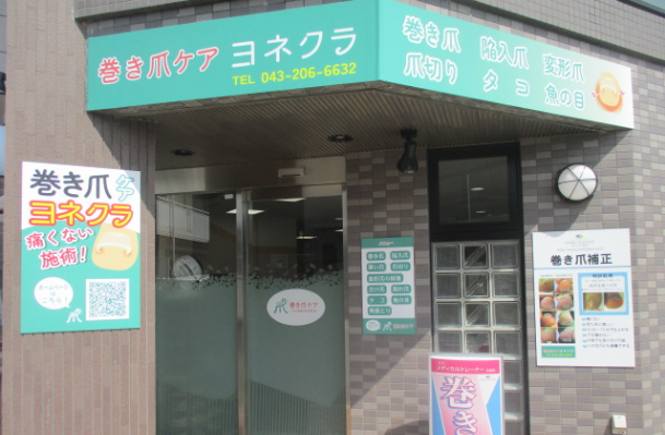 巻き爪ケア ヨネクラ 稲毛店画像